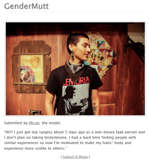 Screenshot of a Genderfork post. A youthful person with short dark hair wearing a black band T-shirt that says "Lemuria", dangly earrings, and a black bandana around their neck. Caption reads "“Hi!!! I just got top surgery about 5 days ago as a non-binary faab person and I don’t plan on taking testosterone. I had a hard time finding people with similar experiences so now I’m motivated to make my trans* body and experience more visible to others.”